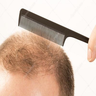 Выпадение волос