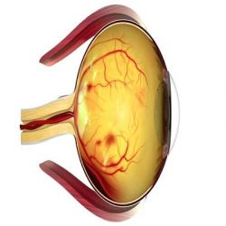 Диабетическая ретинопатия препараты купить, профилактика, симптомы